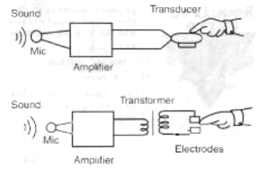 Figure 1 - Hearing through electric and mechanic vibrations
